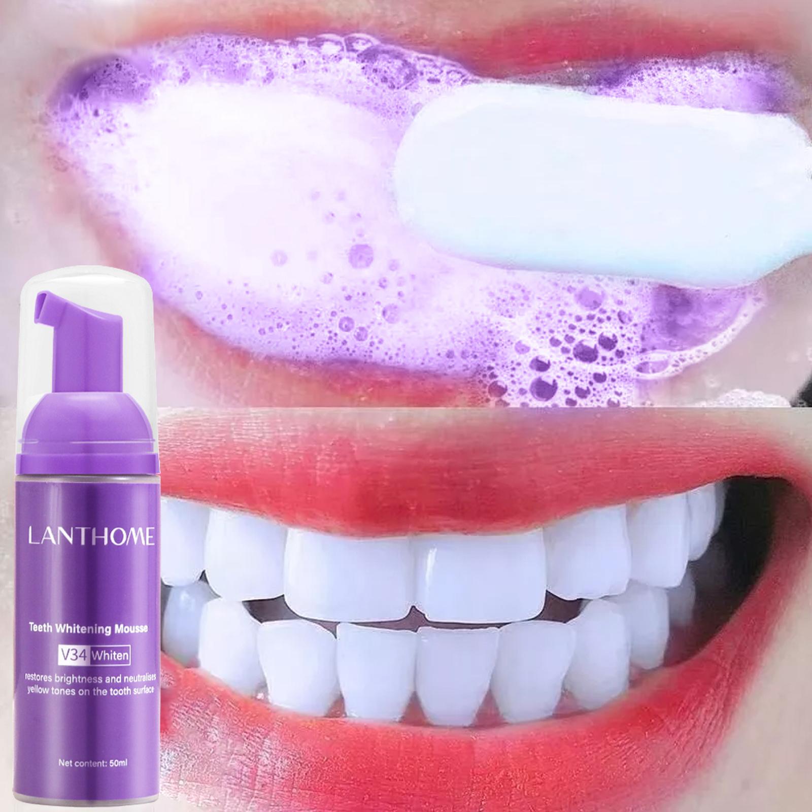 Teeth Whitening Yellow Teeth - V34 무스 치아 청소 치약 효과적인