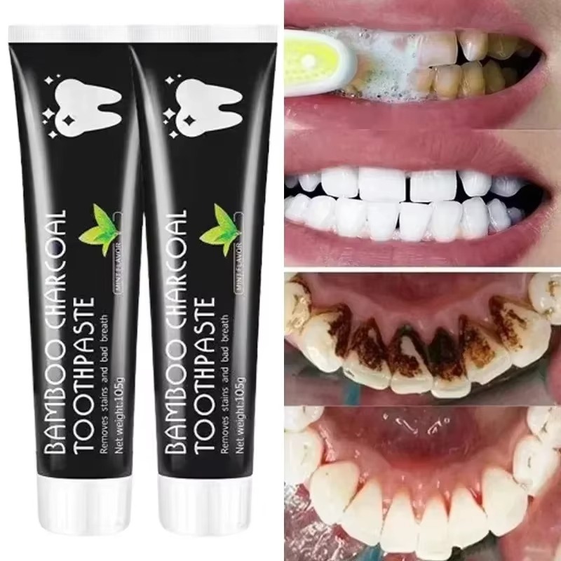 Teeth Whitening Yellow Teeth - 미백 치약 대나무 숯 치약 구취