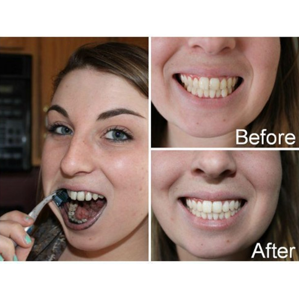 대나무 숯 치아 치아 Dentis Lab 구강 위생 관 - Teeth Whitening Yellow Teeth 리뷰 및 가격