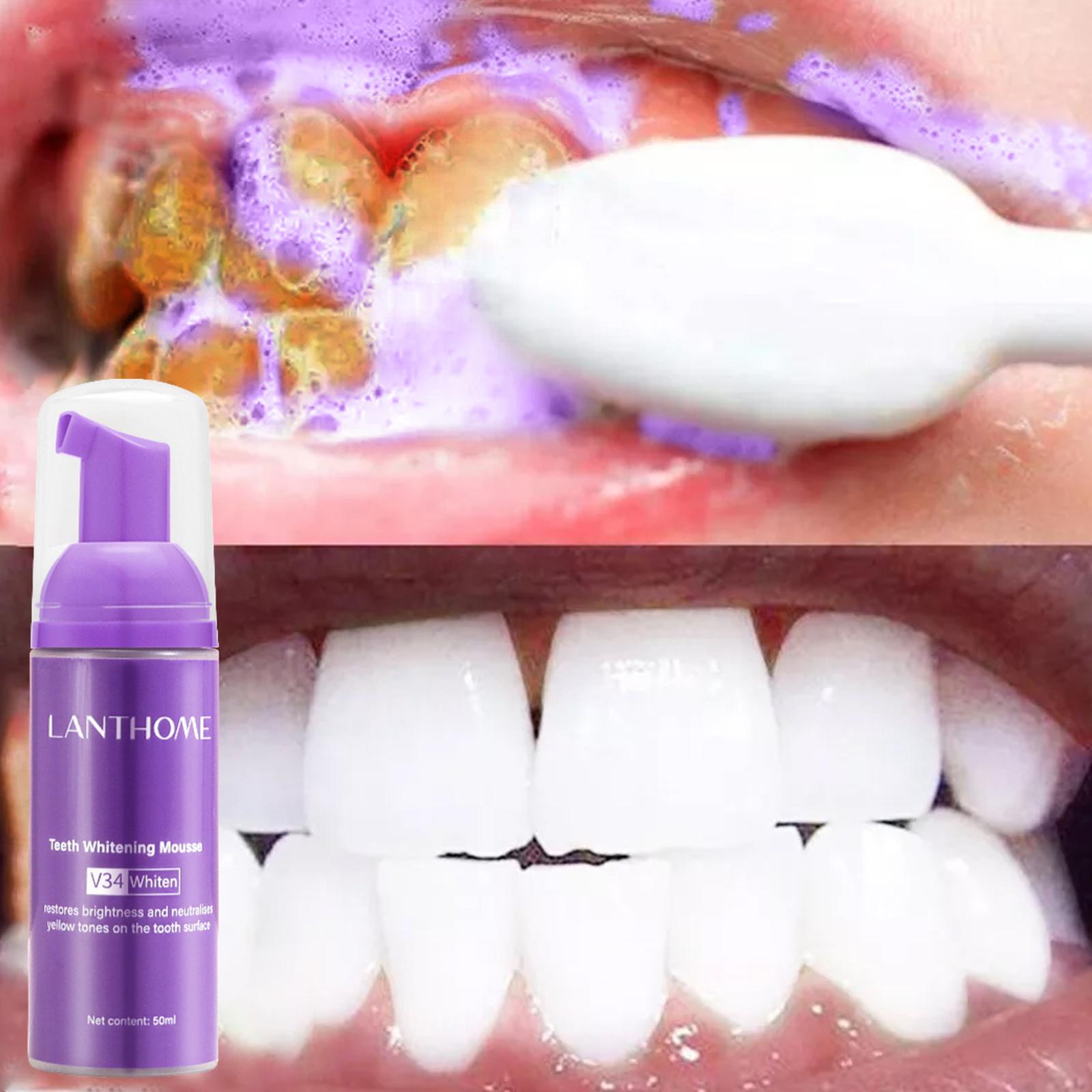 V34 무스 치아 청소 치약 효과적인 브라이트닝 치아  - Teeth Whitening Yellow Teeth 리뷰 및 가격