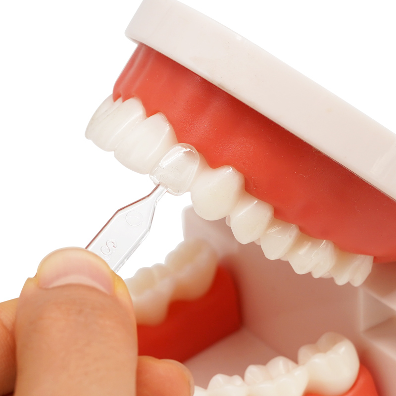 30개 치과용 베니어 몰드 키트 앞니 복합 레진 광중합 - Teeth Whitening Moulds 리뷰 및 가격