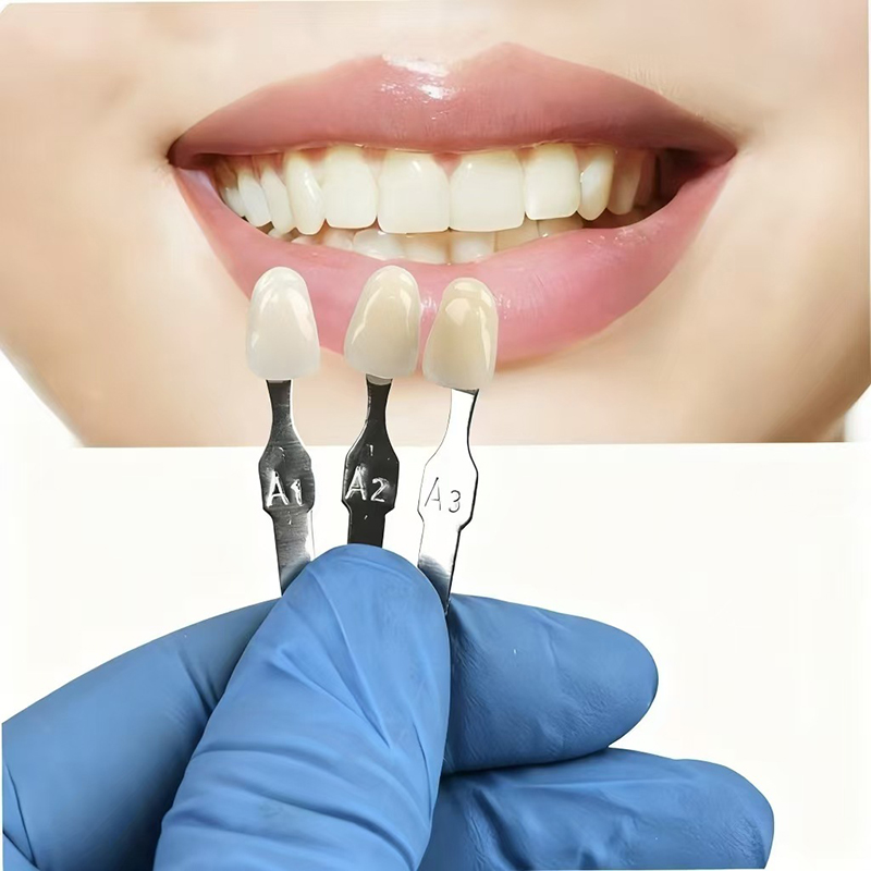 VITA 16색 치아 색상표 클래식 치과용 치아 미백  - Teeth Whitening Shade Guide 리뷰 및 가격