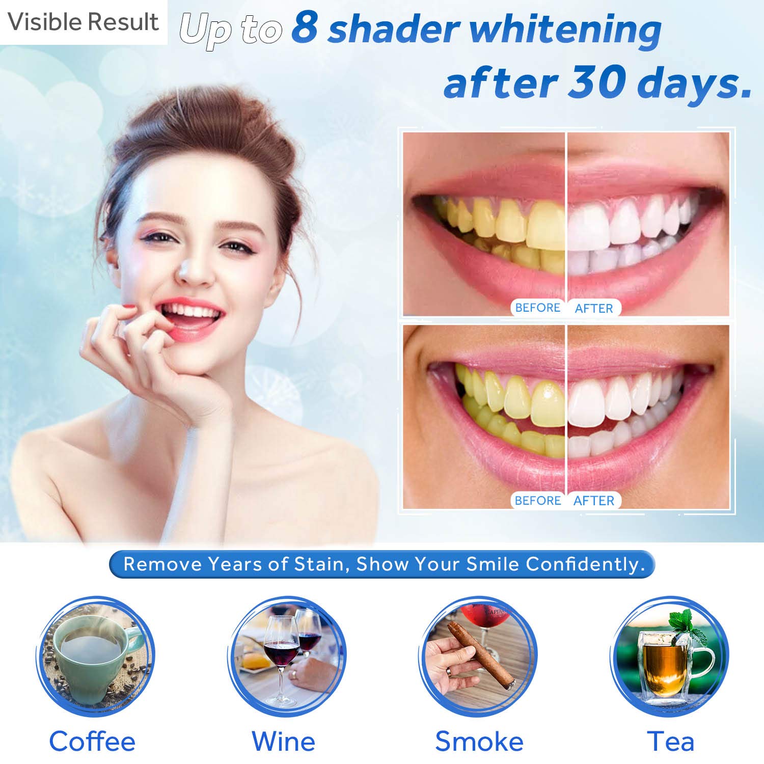 치아 미백 젤 리필 주사기 치아 미백 젤 인비스알라인  - Teeth Whitening Paste 리뷰 및 가격