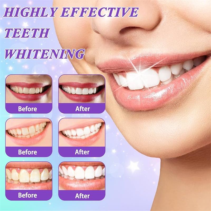 9D 퍼플 치아 미백 치약 무스, 누런 치아 및 플라그 - Teeth Whitening Yellow Teeth 리뷰 및 가격
