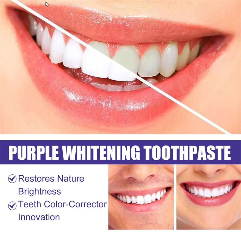 9D 퍼플 치아 미백 치약 무스, 누런 치아 및 플라그 - Teeth Whitening Yellow Teeth 리뷰 및 가격
