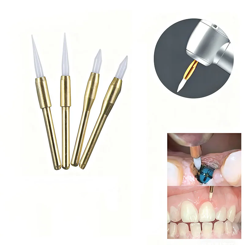 1개 치과용 소프트 트리머 버스 임플란트 수술용 세라믹 - Teeth Whitening Express 리뷰 및 가격