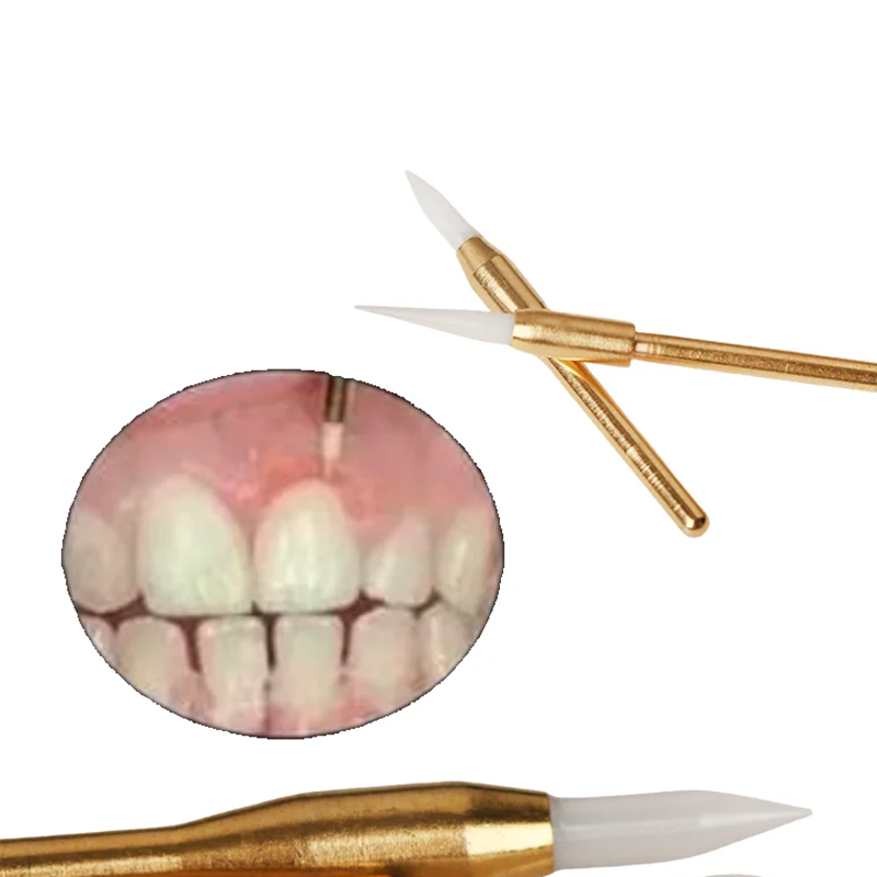 1개 치과용 소프트 트리머 버스 임플란트 수술용 세라믹 - Teeth Whitening Express 리뷰 및 가격