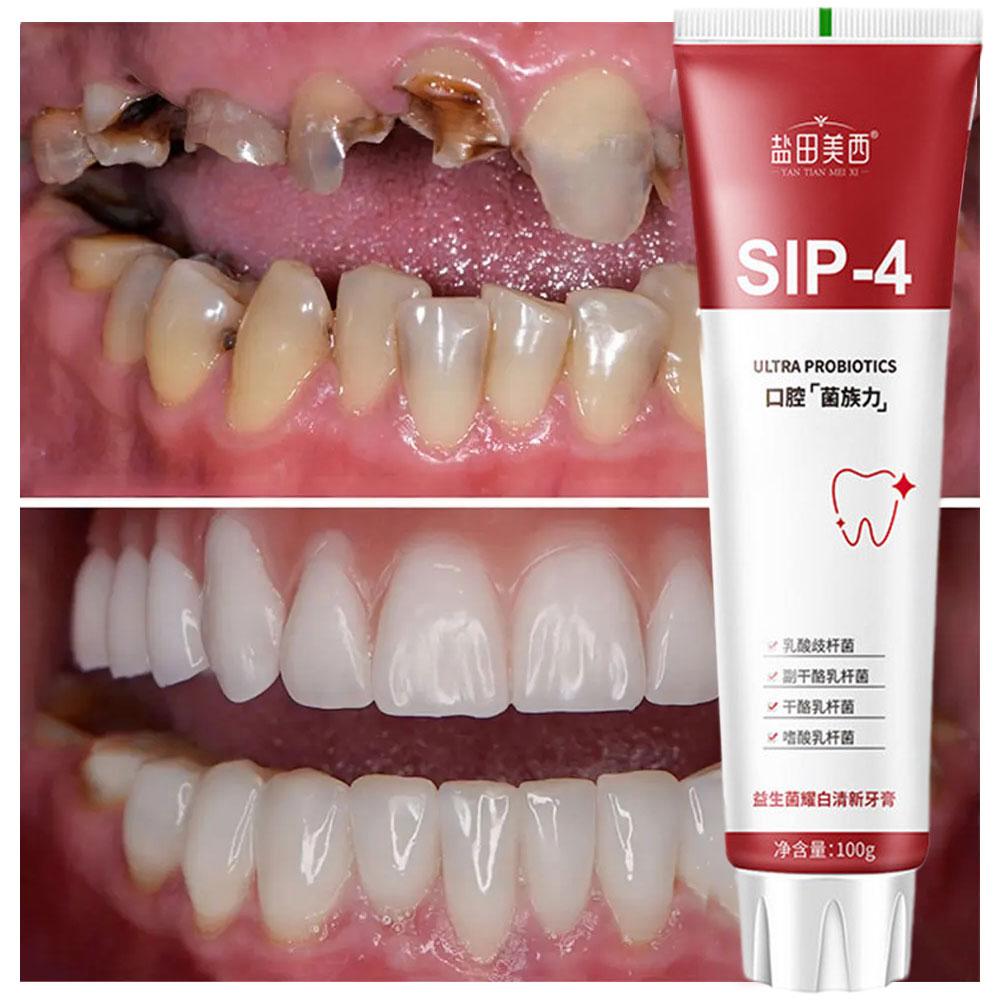 100g Sip-4 프로바이오틱 화이트닝 치약, 황변  - Teeth Whitening Yellow Teeth 리뷰 및 가격
