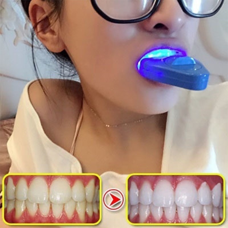 LED 치아 미백 라이트 화이트닝 블루 라이트 UV 라 - Teeth Whitening Uv Light 리뷰 및 가격
